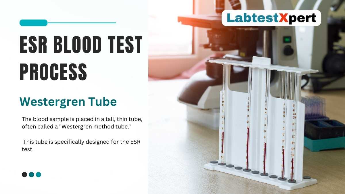 ESR BLOOD TEST 