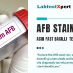 AFB STAIN TEST