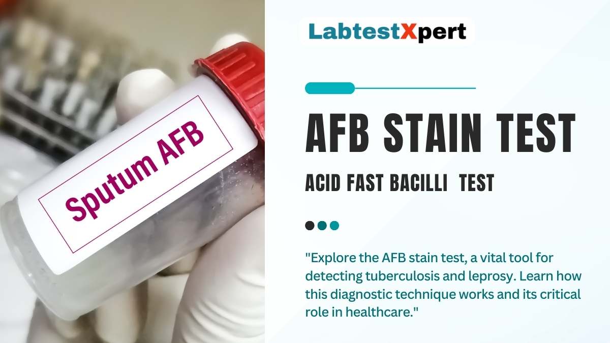 AFB STAIN TEST