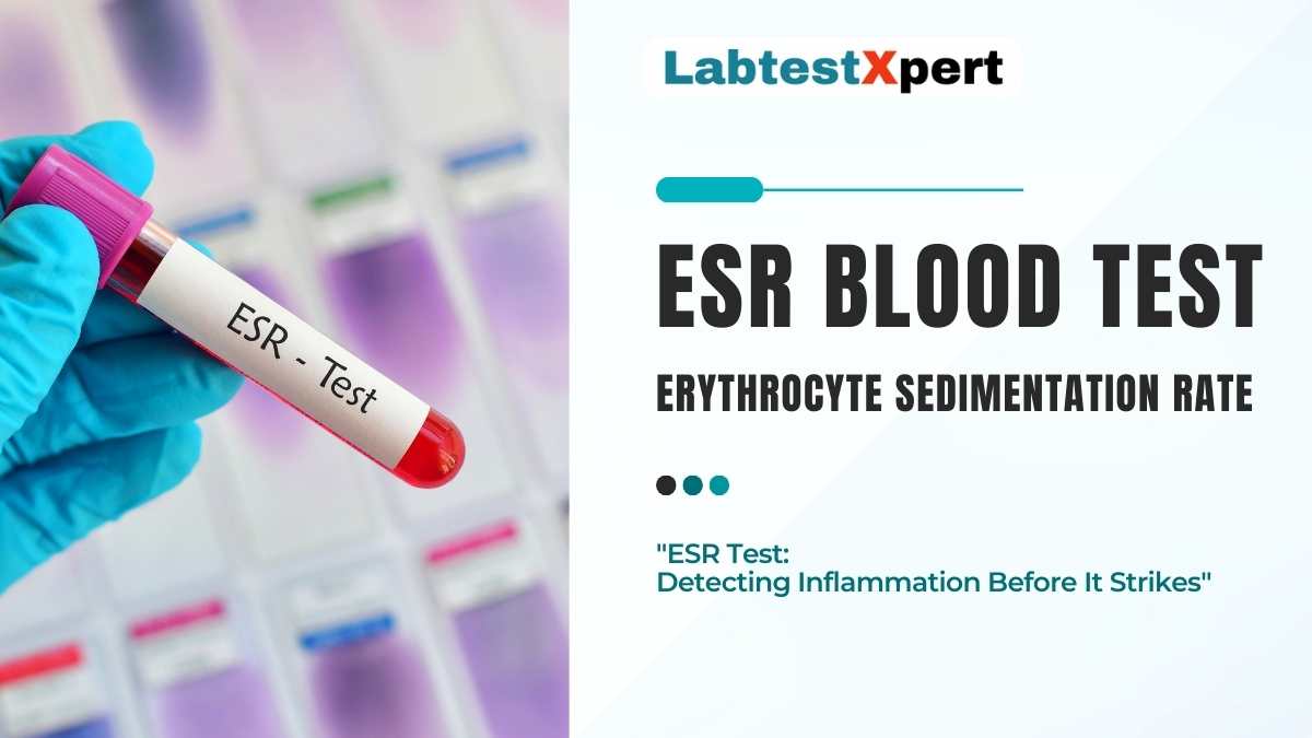 ESR BLOOD TEST