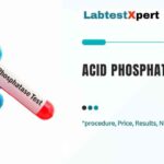 acid phosphatase test