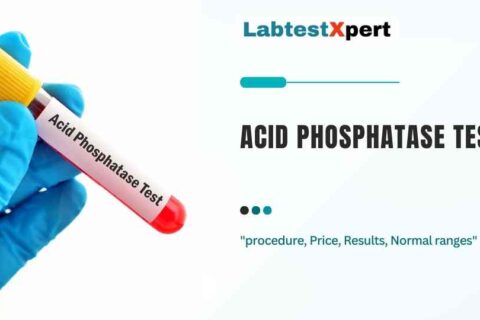 acid phosphatase test