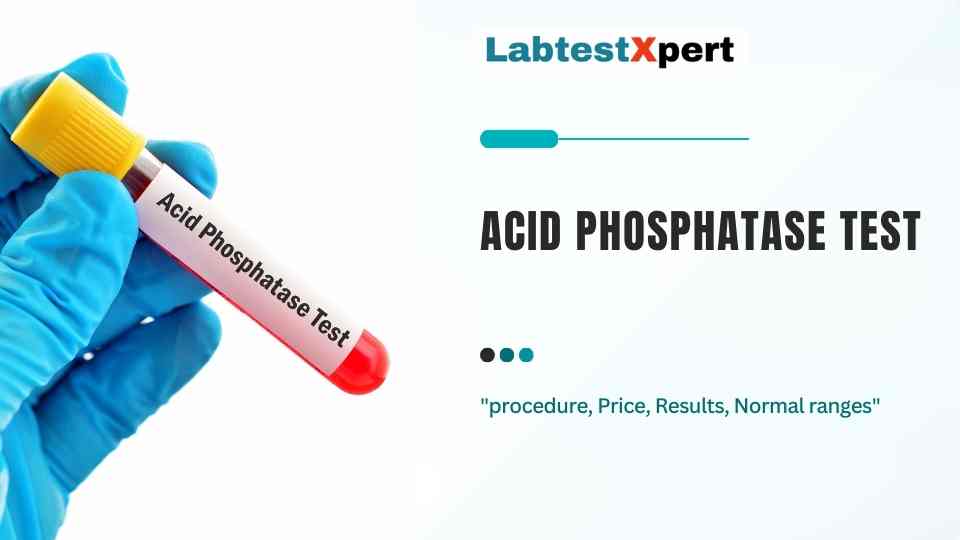 acid phosphatase test