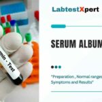 Albumin Blood test