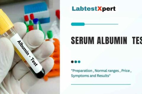 Albumin Blood test