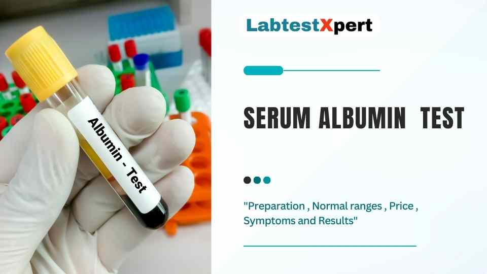 Serum Albumin Blood Test: Preparation , Normal ranges , Price ...