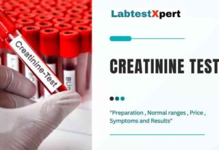 Creatinine Blood test