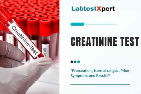 Creatinine Blood test