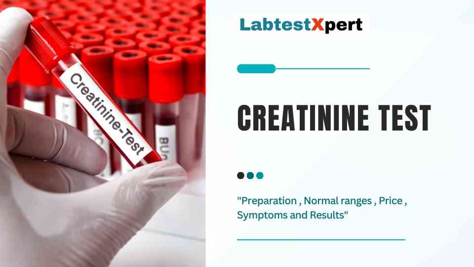 Creatinine Blood test