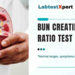 Bun Creatinine ratio test