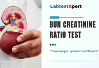 Bun Creatinine ratio test