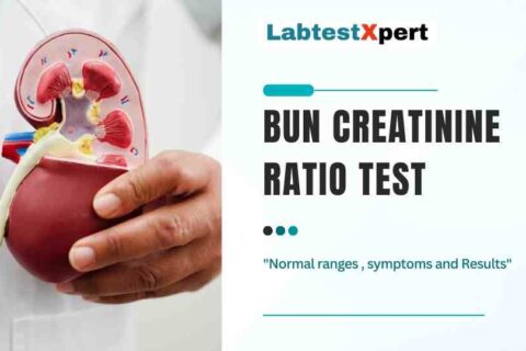 Bun Creatinine ratio test