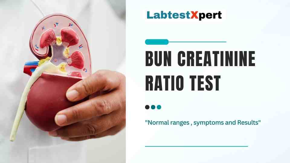 Bun Creatinine ratio test